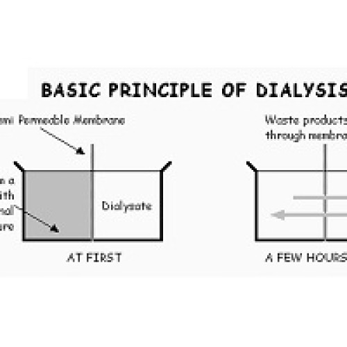 Dialysis concentrates